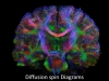 Brain wiring diagram made by high-definition fiber tracking magnetic resonance imaging (HDFT MRI) of water diffusion. The technique is useful for studies of traumatic brain injury.