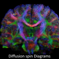 Brain wiring diagram made by high-definition fiber tracking magnetic resonance imaging (HDFT MRI) of water diffusion. The technique is useful for studies of traumatic brain injury.